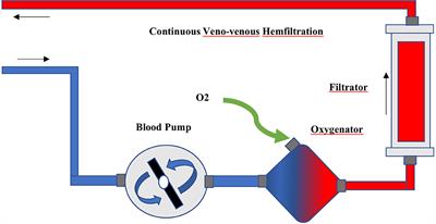 ECCO2R in 12 COVID-19 ARDS Patients With Extremely Low Compliance and Refractory Hypercapnia